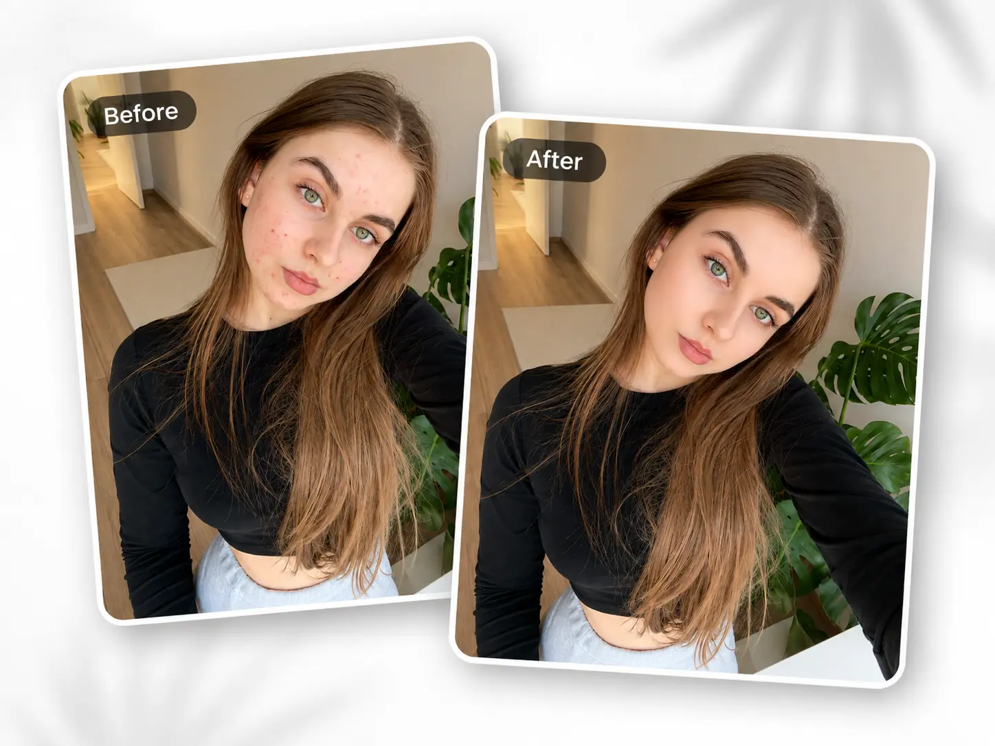 Before-and-after AI beauty retouch comparison for a selfie with acne marks